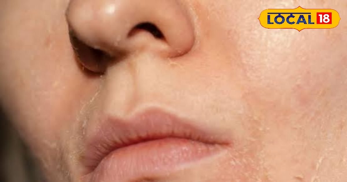 ड्राइनेस को कहें बाय-बाय, चेहरे को बनाएं मुलायम और ग्लोइंग, जानिए टिप्स