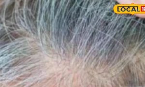 कम उम्र में हो चुके हैं बाल सफेद, तो अपनाएं ये अचूक उपाय, फिर से हो जाएंगे काले, नहीं पड़ेगी हेयर कलर की जरूरत