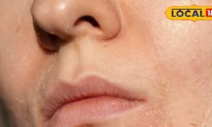 ड्राइनेस को कहें बाय-बाय, चेहरे को बनाएं मुलायम और ग्लोइंग, जानिए टिप्स